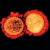 Компьютерные технологии против коронавируса: первые результаты — 2