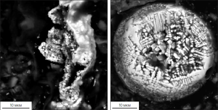 Рис. 7. Техногенные частицы из осадков оз. Комсомольского («Природа» №12, 2019)