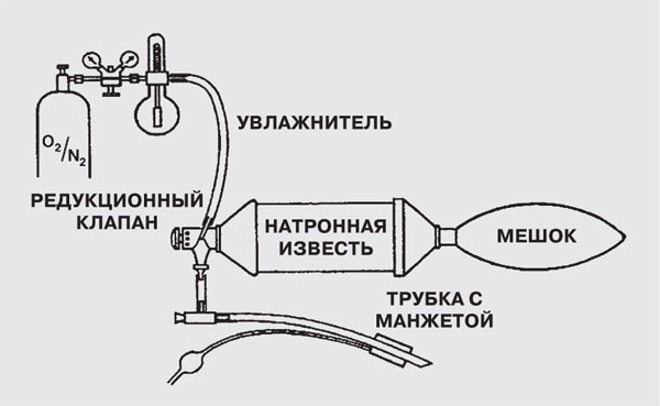 Схема аппарата для ручной механической вентиляции лёгких («Наука и жизнь» №7, 2020)