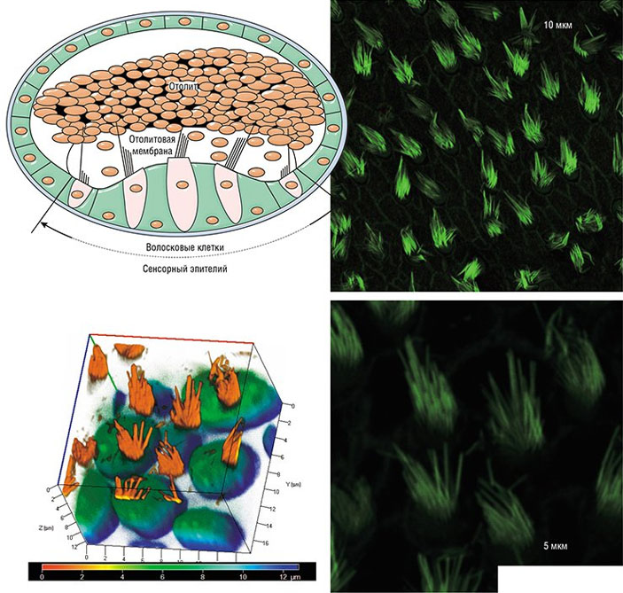На схеме внутреннего уха рыбы показано строение отолита и слухового эпителия. Микрофотографии клеток слухового эпителия байкальских сиговых рыб («Наука из первых рук» №4, 2018)