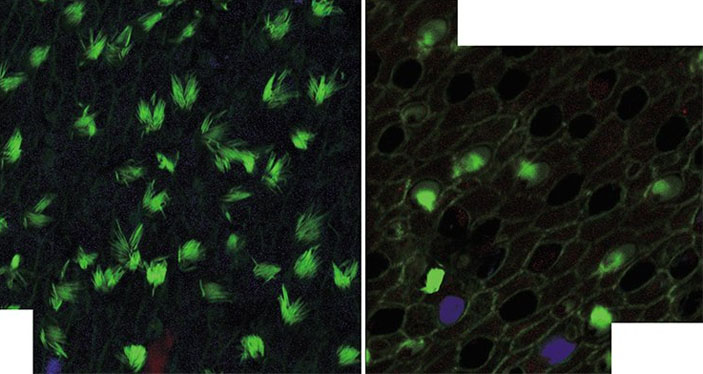 Слуховой эпителий рыб, выращенных в обычных условиях; подвергшихся шумовому воздействию («Наука из первых рук» №4, 2018)