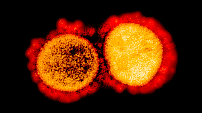Из-за мутации коронавирус обрел способность связываться с клетками тканей человека. Фото: NIAID («Химия и жизнь» №3, 2022)