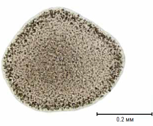 Trichoplax adhaerens