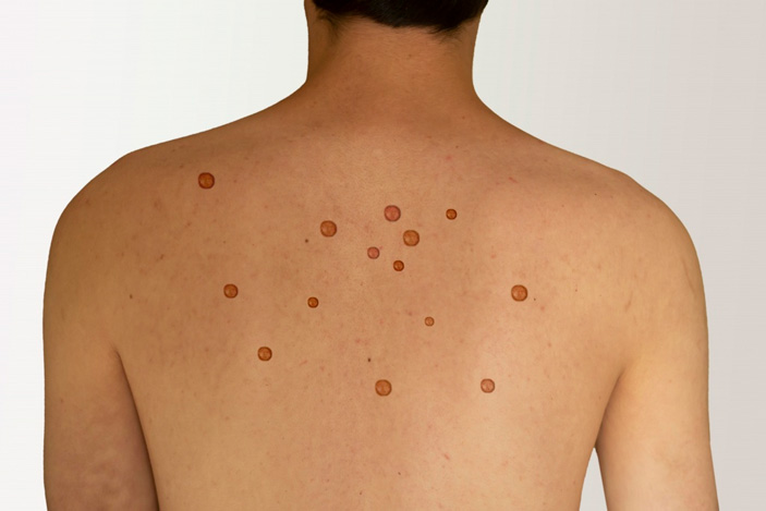 Фото: picture alliance / CHROMORANGE («Химия и жизнь» №6, 2022)