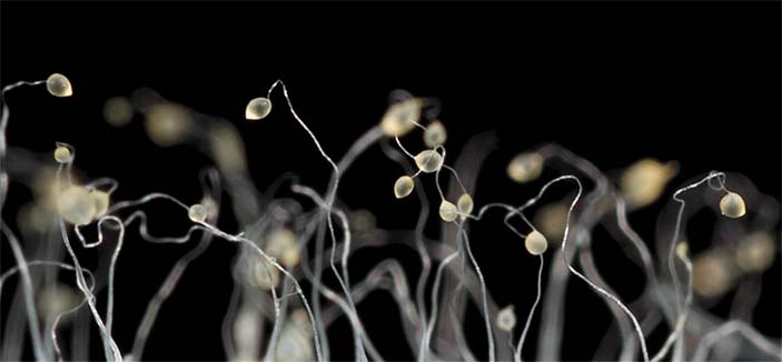 Зрелые плодовые тела слизевика D. discoideum