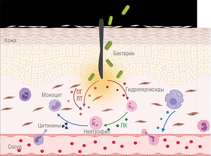 При внедрении инфекционного агента обычно развивается воспалительный процесс