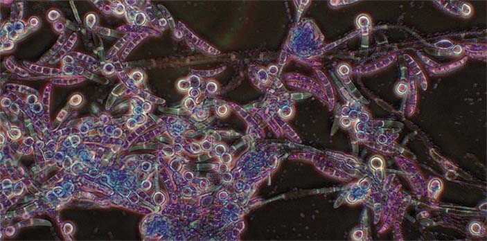 Представитель оомицетов – паразитический вид Pythium insidiosum