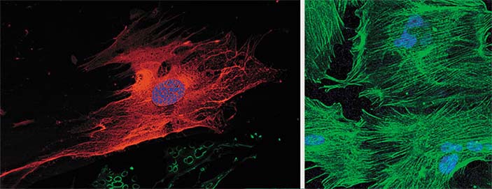 Мезенхимальные стволовые клетки (МСК) обнаруживаются в небольшом количестве в большинстве тканей взрослого организма