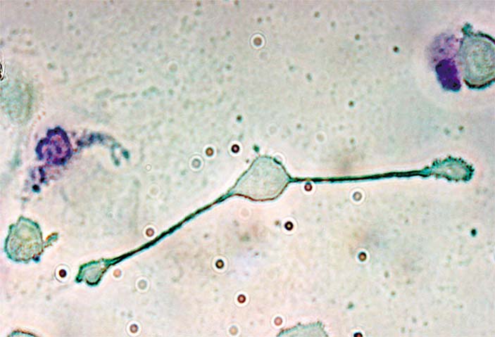 Макрофаги присутствуют практически в каждом органе и ткани