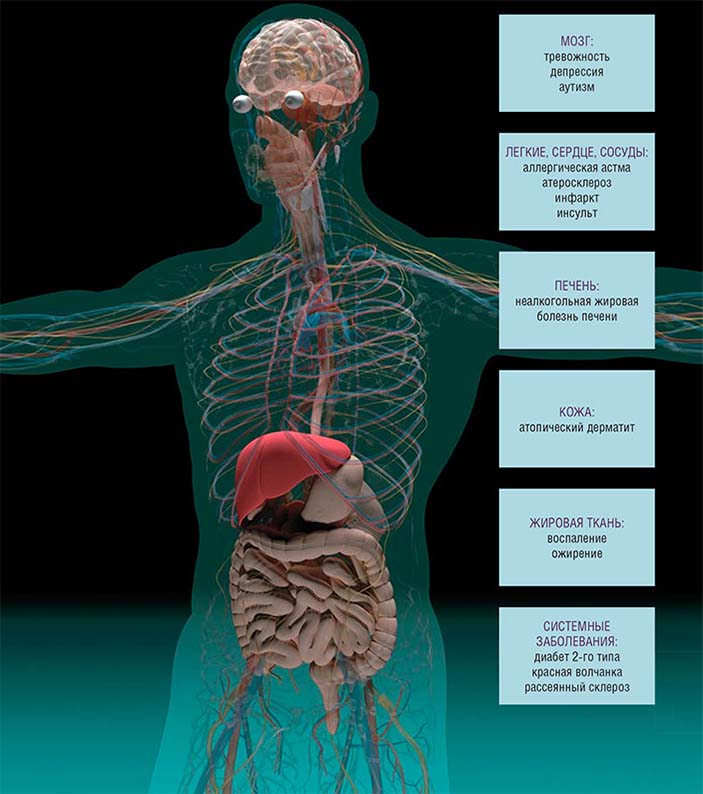 С дисбалансом кишечной микрофлоры связано развитие болезней