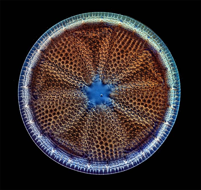 17. Диатомовые водоросли (Actnioptychus)