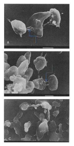 Рис. 4. Сверху вниз: система генетического обмена галофильных архей Haloferax volcanii образование цитоплазматических мостиков и передача геномной ДНК; спаривание галоархей H. volcanii