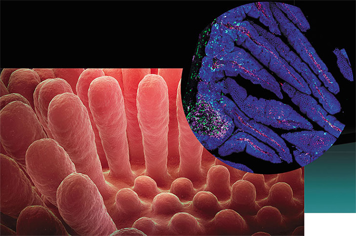 Слизистая тонкой кишки в нормальном состоянии