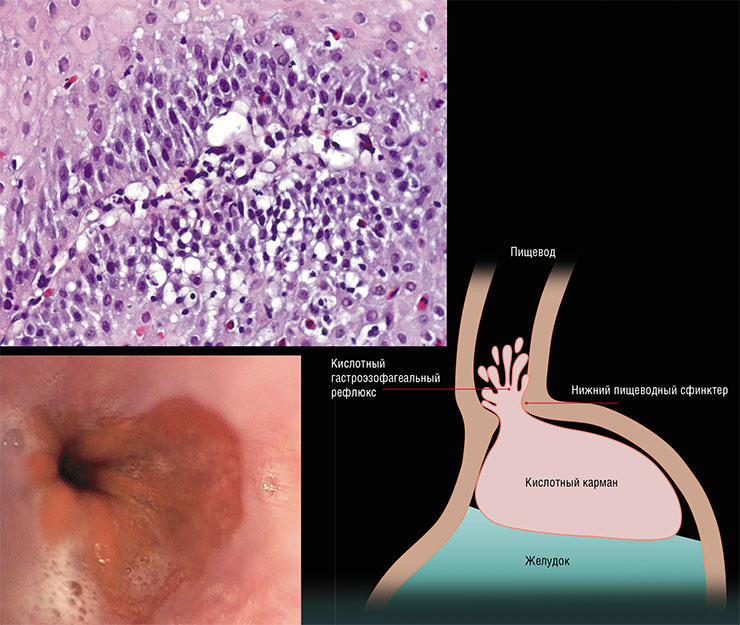 Гистологический образец ткани пищевода