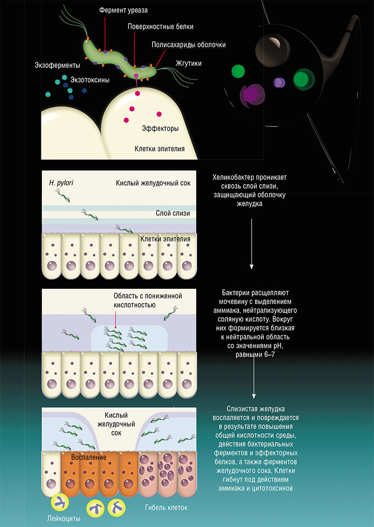 Бактерия Helicobacter pylori