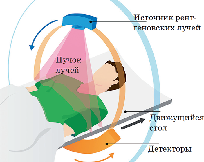 Как получают послойное изображение