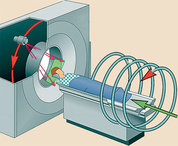 Спиральная компьютерная томография