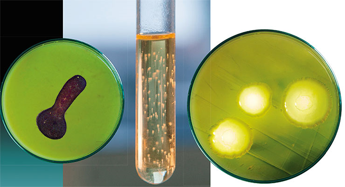 Колонии бифидобактерий Bifidobacterium longum