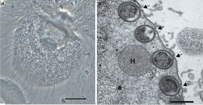Электронные микрофотографии жгутикового Trichonympha agilis