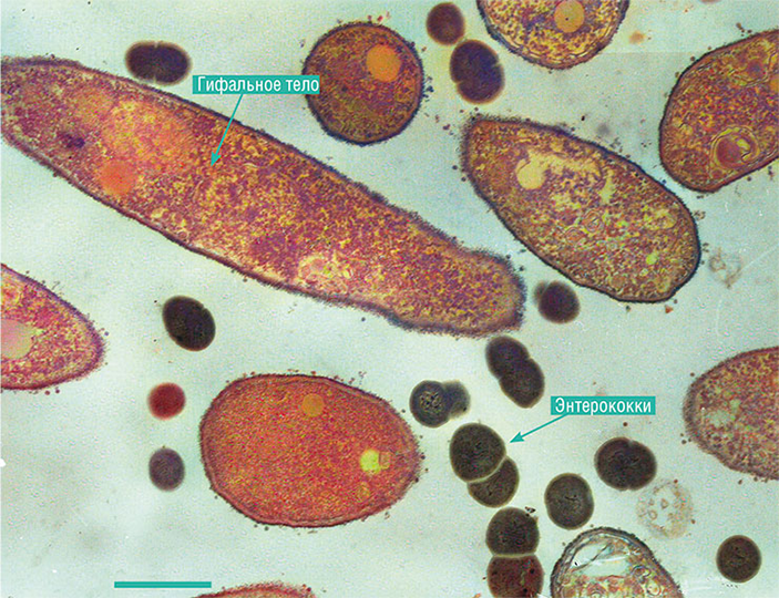 грибные гифальные тела