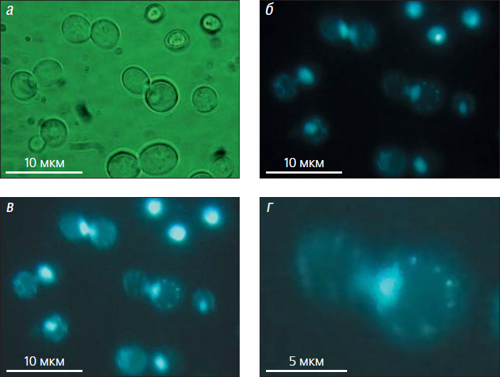 Рис. 1. Компьютерная обработка флуоресцентного изображения для улучшения визуального восприятия