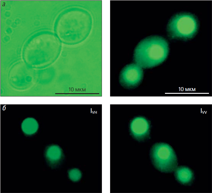 Рис. 8. Определение вязкости в вакуолях дрожжей Saccharomyces cerevisiae c помощью ЦФМ по анизотропии флуоресценции хинакрина
