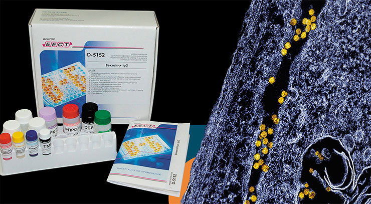 Частицы вируса Западного Нила в цитоплазме инфицированной клетки клеточной культуры VERO E6; Наборы для генетической диагностики вируса Западного Нила