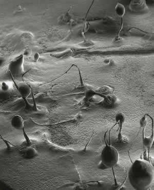 D. discoideum. Фото с сайта www.the-scientist.com