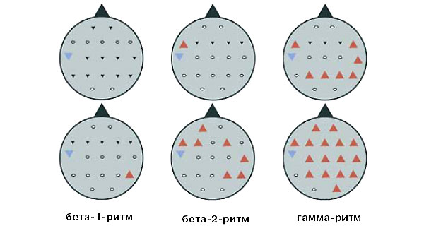 Увеличение (красным) и снижение (синим) мощности ритмов при решении креативной задачи по сравнению с некреативной. Вверху: изображение своей собственной картинки. Внизу: изображение заданных предметов. Изображение: «Химия и жизнь»
