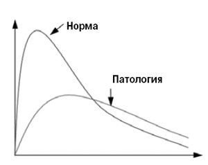 <b>Рис. 2.</b> Изменение концентрации метацетина во времени при нормальной работе печени и в случае болезни
