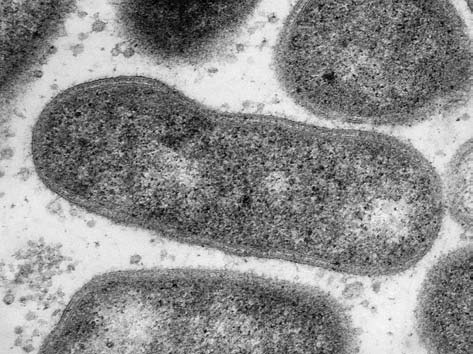 Прокариотическая клетка (электронная микроскопия)