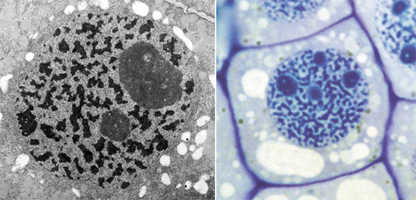Интерфазная клетка растений (слева: электронная микроскопия, справа: световая микроскопия)