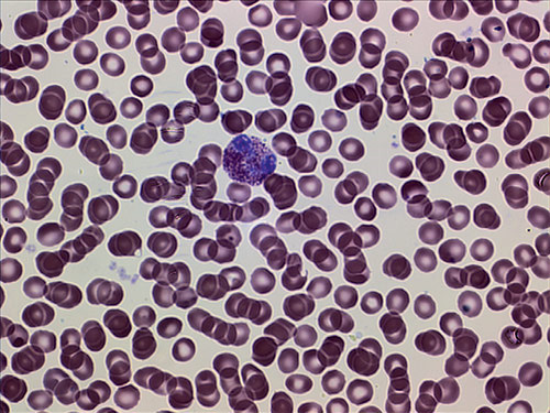 Мазок крови. Окраска азур-эозином по Романовскому. Увеличение 1000×. На фотографии: эозинофил на фоне эритроцитов