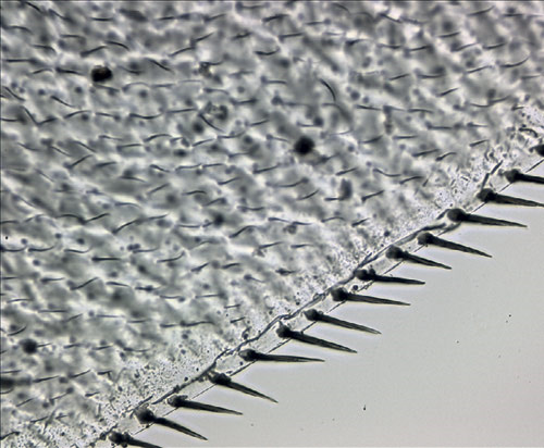 Крыло жучка бибиониды. Увеличение 400×