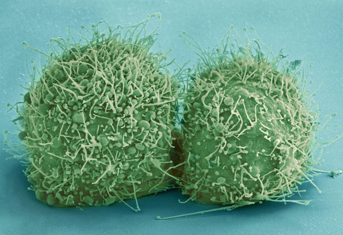 Клетки линии HeLa («Природа» №2, 2016)