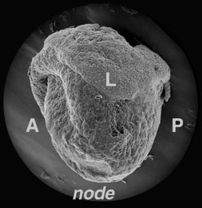 Рис. 4. Зародыш мыши на стадии 8,25 дня, вид слева: передняя часть — А, задняя — Р, буквой L отмечена левая боковая пластинка. Внизу виден гензеновский узелок (node). Изображение получено методом сканирующей электронной микроскопии (Hamada et al., Nature Review Genetics, 2002,3,2,103–113)