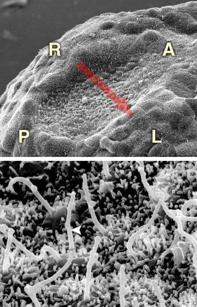 <b>Рис. 5. </b>Гензеновский узелок эмбриона мыши с увеличением 600 (<i>вверху</i>) и 6000. <b>А</b> и <b>Р</b> — передняя и задние части эмбриона, <b>L</b> и <b>R</b> — левая и правая половины тела. <i>Стрелкой</i> на нижней фотографии отмечена ресничка