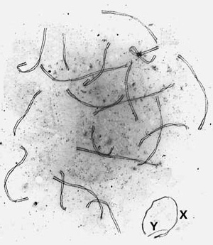 Рис. 5. Полный набор распластанных на подложке синаптонемных комплексов из сперматицита мыши. Видны 19 сформированных комплексов и контактирующие концами белковые оси половых хромосом (XY). Фото О.Л. Коломиец. Изображение: «Природа»