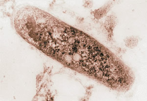Электронная микрофотография загадочной бактерии Micobacterium tuberculosis