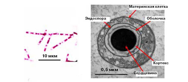 <b>Рис. 6.</b> Эндоспоры сенной палочки<i> Bacillus subtilis </i>в световом микроскопе (<i>слева</i>) видны как бесцветные включения, невосприимчивые к красителю. При электронной микроскопии (<i>справа</i>) выявляется структура споры с многослойной оболочкой и электронно-плотной сердцевиной
