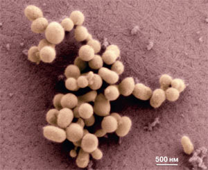 Электронная микрофотография синтетической бактерии Mycoplasma mycoides. Изображение: «Наука и жизнь»