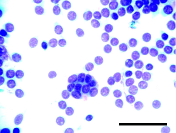 Рисунок 4. Клетки неоплазмы тасманийского дьявола. Изображение с сайта vet.sagepub.com