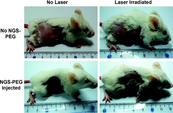 Типичные фотографии мышей из четырех групп, участвовавших в эксперименте. NGS-PEG — графен, покрытый полиэтиленгликолем (nanographene sheets with polyethylene glycol). Видно, что у мыши, инъецированной графеном и облученной лазером, опухоль уничтожена. Изображение из обсуждаемой статьи в Nano Letters