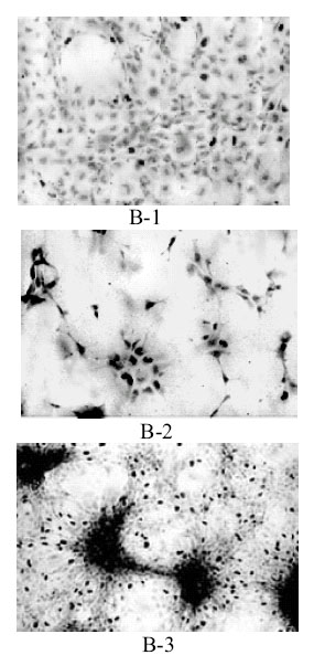 Количество многоядерных клеток хвостовых мышц рыбы гольяна при фоновых значениях космического излучения (В-1), во время подъема уровня нейтронов у поверхности земли (В-2) и во время геомагнитной бури (В-3). Изображение с сайта http://www.kosmofizika.ru