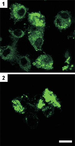 Макрофаги костного мозга, зараженного (1) новым генно-инженерным штаммом БЦЖ и (2) стандартной БЦЖ-вакциной. Длина масштабной полосы — 10 мкм (фото с сайта www.jci.org)