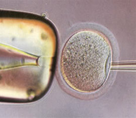 Процесс извлечения ядра из клетки.