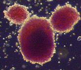 Недифференцированные эмбриональные стволовые клетки можно использовать для создания клеток крови — например, «естественных киллеров» или красных кровяных клеток (на фото). Изображение с сайта www1.umn.edu