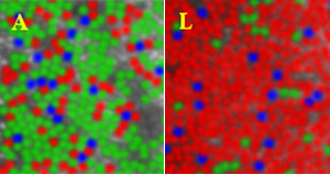 На этих снимках хорошо виден разброс доли колбочек, отвечающих за восприятие разных цветов. На правом снимке преобладают колбочки, отвечающие за восприятие оттенков красного (слева и справа — снимки живой сетчатки двух разных людей). Фото с сайта www.rochester.edu