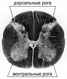 Поперечное сечение спинного мозга. Видна
