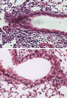 Аллергическое воспаление дыхательных путей (лиловый цвет) у зараженных паразитами мышей (внизу) было значительно меньше (фото с сайта www.jem.org)